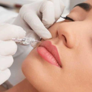 Procedimiento — Aumento de labios con ácido hialurónico