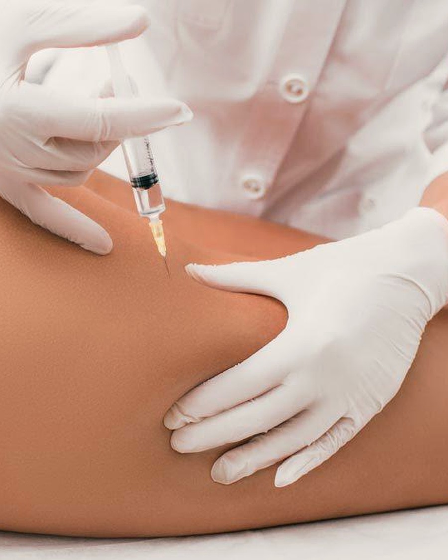 Mesoterapia corporal en Nerja