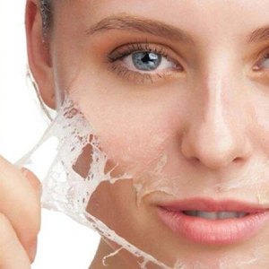 Recuperación — Peeling químico
