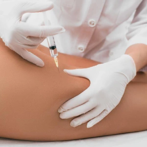 Procedimiento — Mesoterapia corporal en Nerja