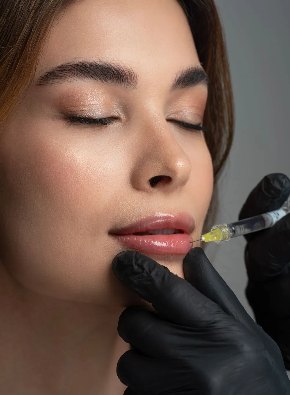 Aumento de labios con ácido hialurónico